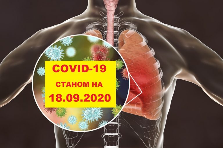 COVID-19 У ЯМНИЦЬКІЙ ОТГ СТАНОМ НА 18.09.2020