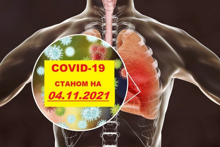 COVID-19 У ЯМНИЦЬКІЙ ГРОМАДІ СТАНОМ НА 04.11.2021